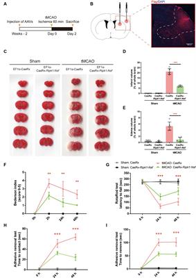 Downregulation of Ripk1 and Nsf mediated by CRISPR-CasRx ameliorates stroke volume and neurological deficits after ischemia stroke in mice